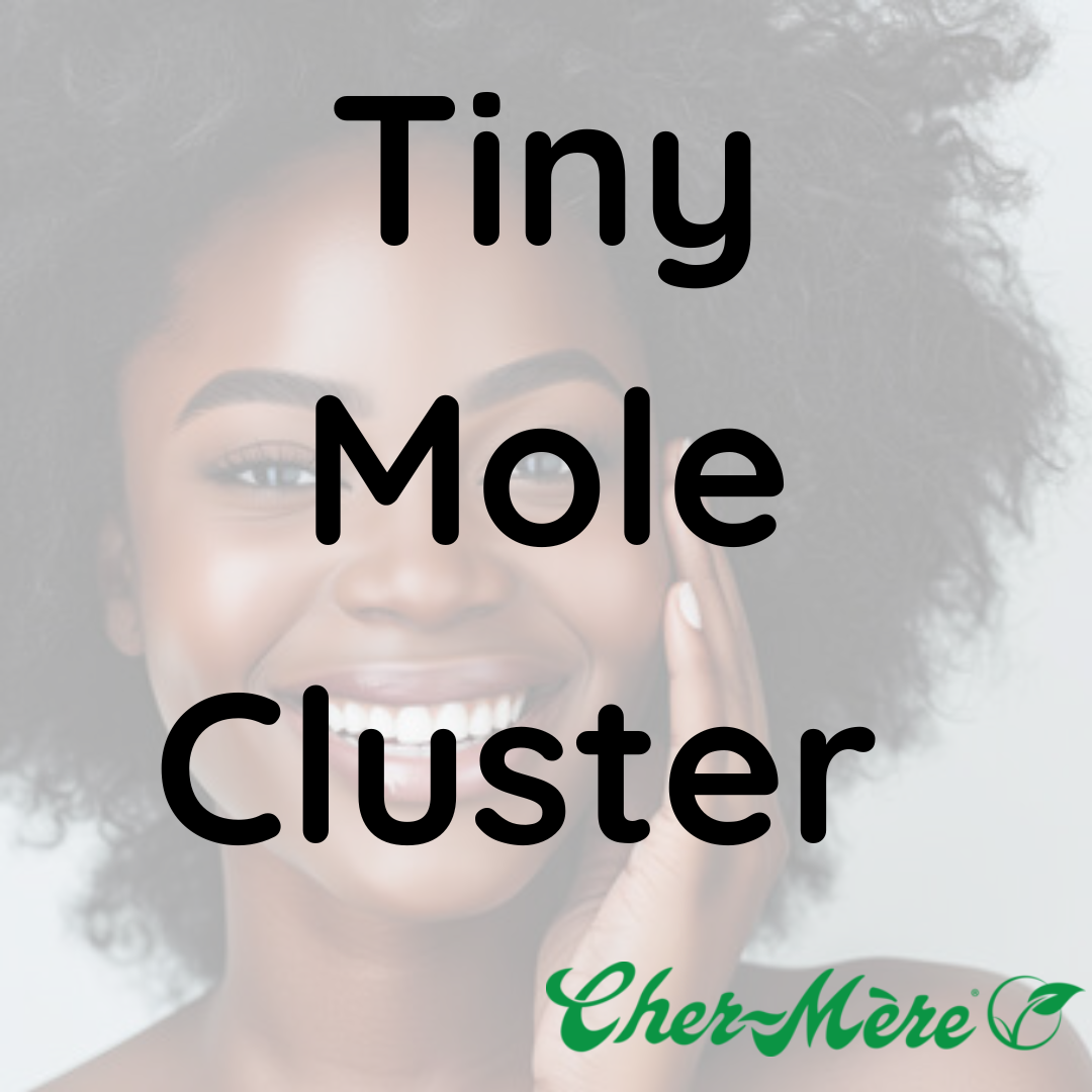 Tiny Mole Cluster